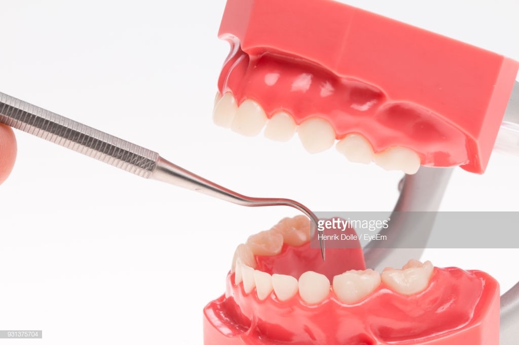 Make Your Own Dentures Voca TX 76887